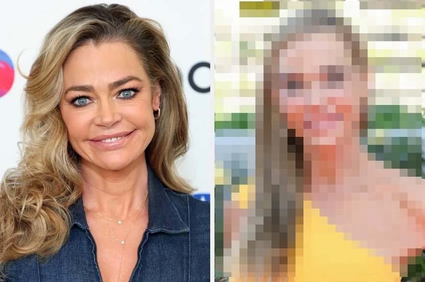 Denise Richards' Jaw-Dropping Facelift Transformation: See the Stunning Results!