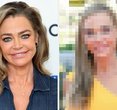 Denise Richards' Jaw-Dropping Facelift Transformation: See the Stunning Results!