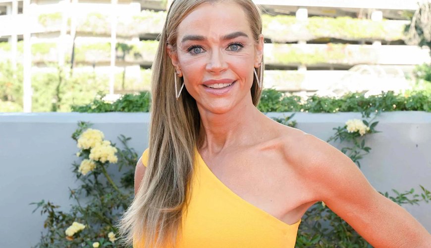 Denise Richards Reveals Her Stunning Facelift Transformation: 'It's Night and Day'