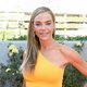 Denise Richards Reveals Her Stunning Facelift Transformation: 'It's Night and Day'