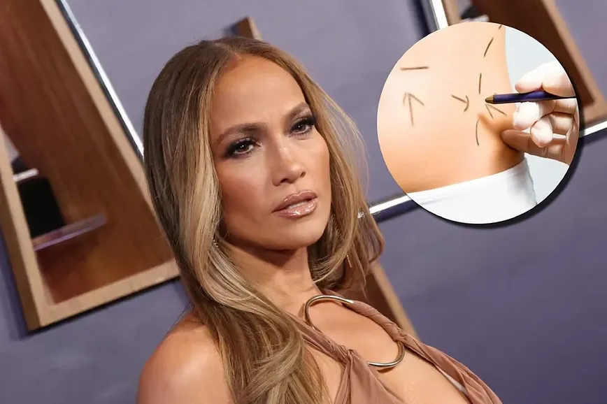 J.Lo's New Year Resolution: More Cosmetic Surgeries Spark Concern
