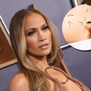 J.Lo's New Year Resolution: More Cosmetic Surgeries Spark Concern