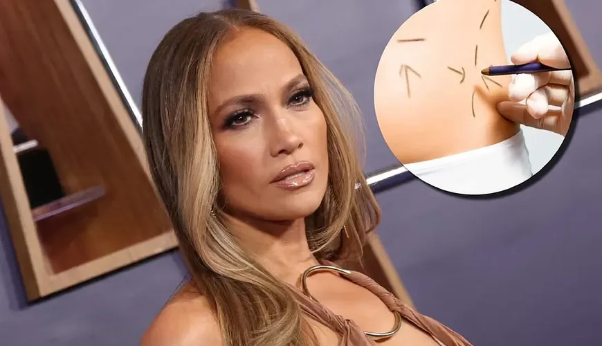 J.Lo's New Year Resolution: More Cosmetic Surgeries Spark Concern