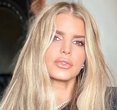 Jessica Simpson's Glamorous Comeback: Fans Buzz Over New Project and a Bruised Knee