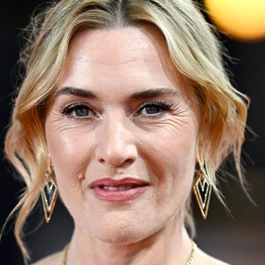 Kate Winslet Slams Cosmetic Surgery Trends as 'Terrifying'