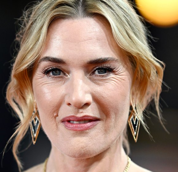 Kate Winslet Slams Cosmetic Surgery Trends as 'Terrifying'