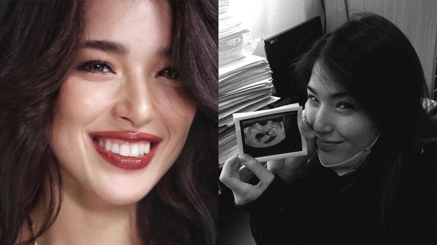 Kylie Padilla's Nostalgic 2016 Throwback: A Year of Transformation