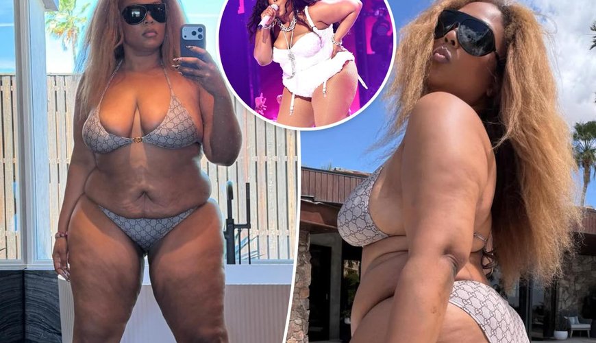 Lizzo Flaunts Stunning 60-Pound Weight Loss in Bold Bikini Pics