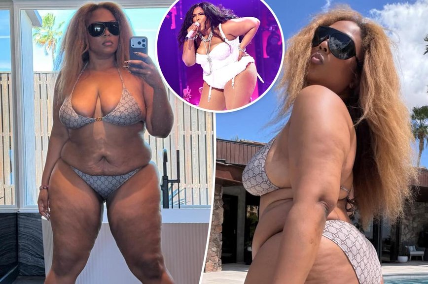 Lizzo Flaunts Stunning 60-Pound Weight Loss in Bold Bikini Pics