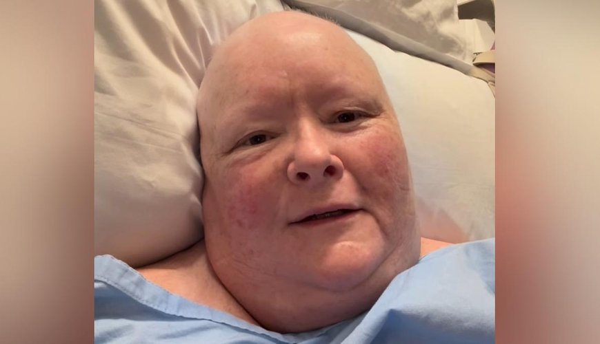 Magda Szubanski Sounds Alarm on Heartless Cancer Scam