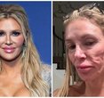 Brandi Glanville's Tumor Diagnosis: The Mystery Behind Her Facial Disfigurement