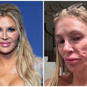 Brandi Glanville's Tumor Diagnosis: The Mystery Behind Her Facial Disfigurement