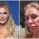 Brandi Glanville's Tumor Diagnosis: The Mystery Behind Her Facial Disfigurement