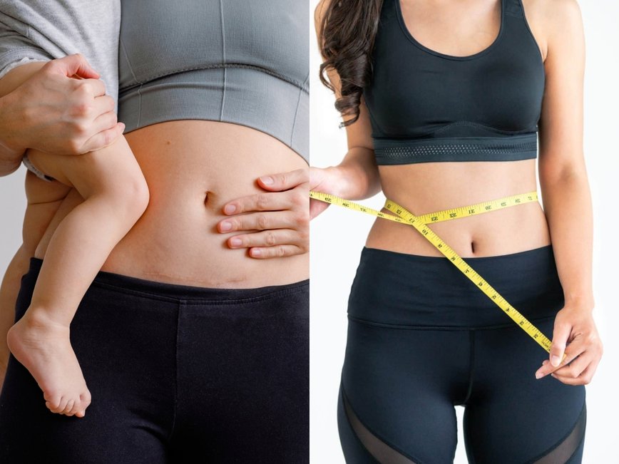 Celebrity Secrets: How Stars Shed Baby Weight in Record Time