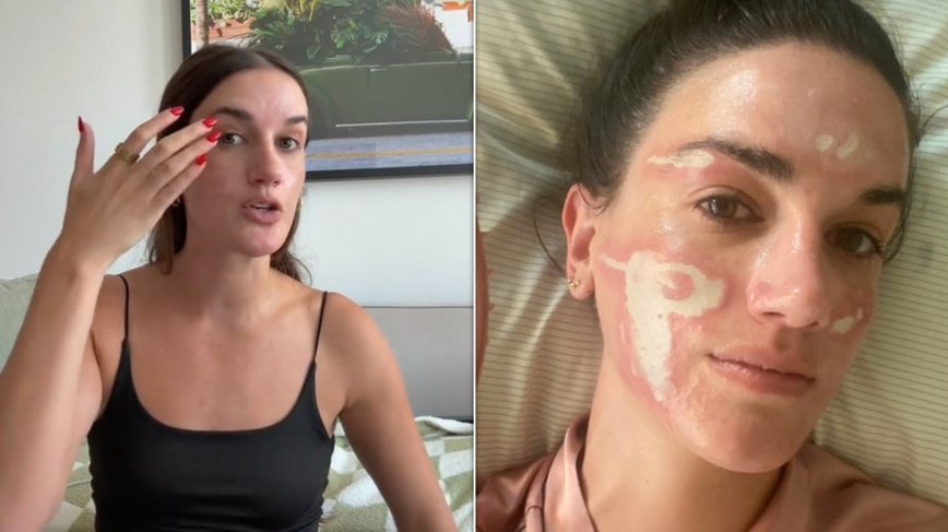 Celebrity Skincare Guru Faces Legal Heat Over Alleged Facial Disaster