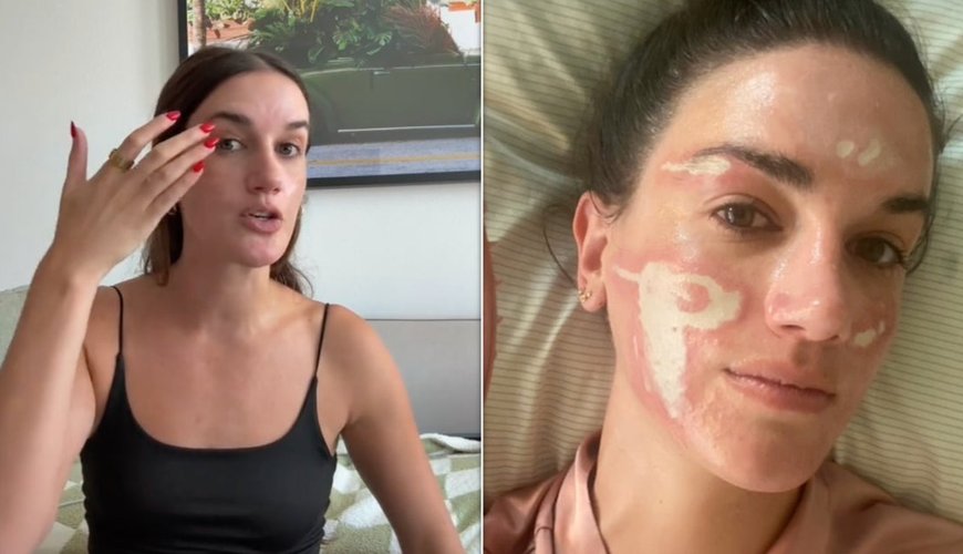 Celebrity Skincare Guru Faces Legal Heat Over Alleged Facial Disaster